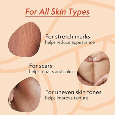 ⁦Nature Spell Stretch Mark Body Oil 100ml AMZ⁩ – תמונה ⁦3⁩