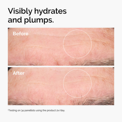 ⁦The Ordinary The Renewal Set for Signs of Aging⁩ – תמונה ⁦6⁩