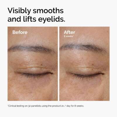 The Ordinary Lacto-PDRN* 4% + B9 Eye Cream 15ml – תמונה 8