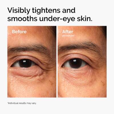 The Ordinary Lacto-PDRN* 4% + B9 Eye Cream 15ml – תמונה 7